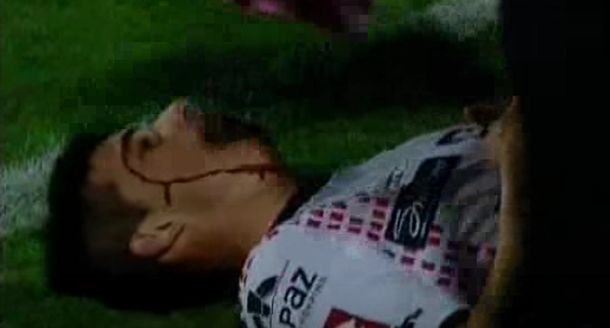 Con lo que cuesta hacer goles: dos jugadores se lastimaron en el festejo