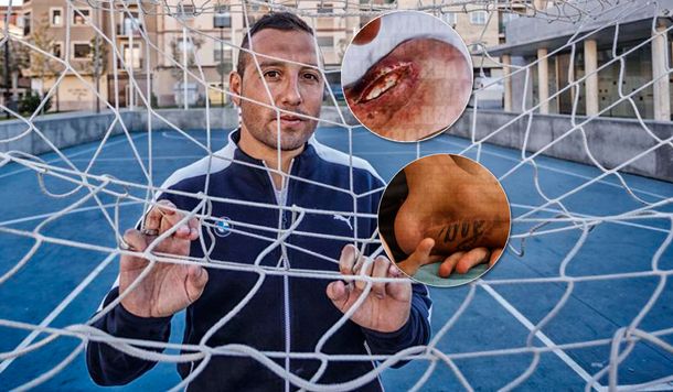 El calvario de Santi Cazorla: no puede volver a jugar y le injertaron piel del antebrazo en el tobillo