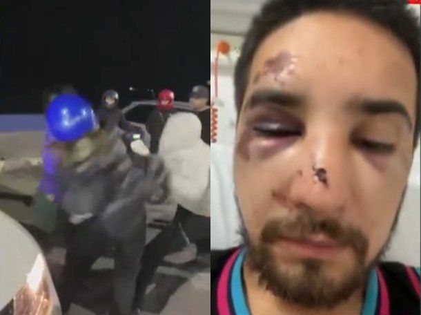 Furia y descontrol en Río Gallegos: una discusión de tránsito derivó en una feroz pelea