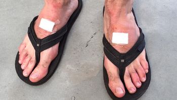 tras la batalla ante souza, asi estan hoy los pies de leonardo mayer tras la batalla ante souza, asi estan hoy los pies de leonardo mayer