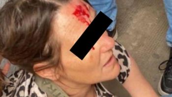 ataque en un colegio de la plata: un exalumno irrumpio y golpeo a varios estudiantes ataque en un colegio de la plata: un exalumno irrumpio y golpeo a varios estudiantes