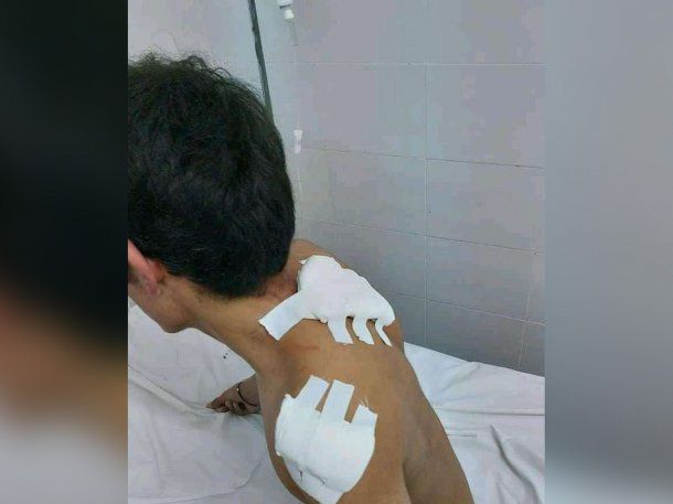 Salta: apuñaló a su compañero porque se puso de novio con su hermana