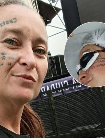 Geraldine Prais mostró cómo le quedó la cara tras sacarse los tatuajes: ¿se hizo uno nuevo?