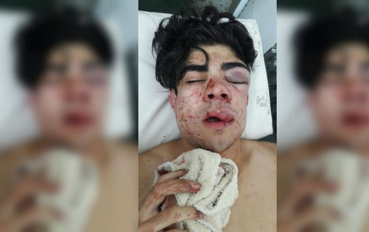 El adolescente de 18 años terminó internado