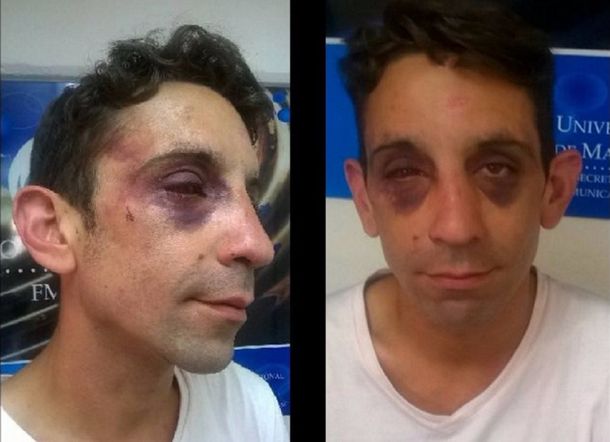 Un joven gay denuncia haber sido salvajemente golpeado por una patota neonazi
