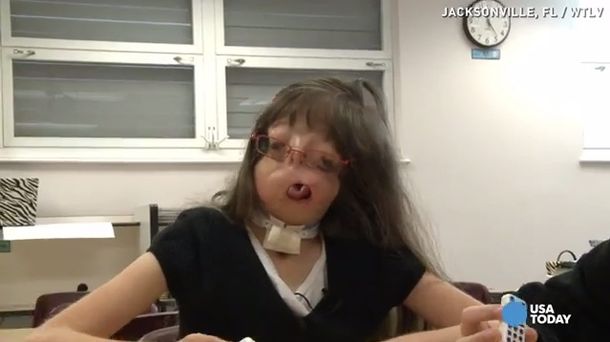 El conmovedor caso de una niña que nació sin cara