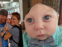 Cumplió un año el nene que nació sin medio cráneo