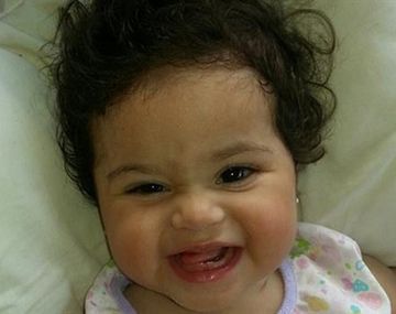 Dieron de alta a la siamesa operada