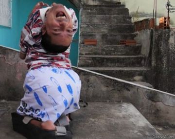 El hombre que nació con la cabeza al revés