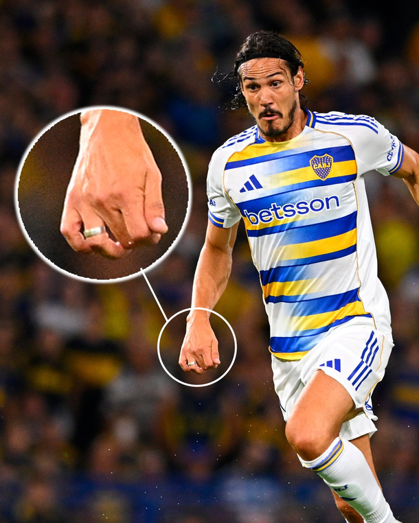Edinson Cavani jug&oacute; con un anillo en Boca. Foto gentileza Bolavip.
