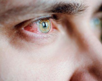 Cómo saber si tuviste Covid-19 y no te diste cuenta