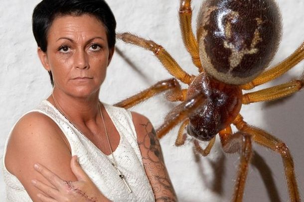 Una mujer pierde el dedo índice después de que la mordió una araña