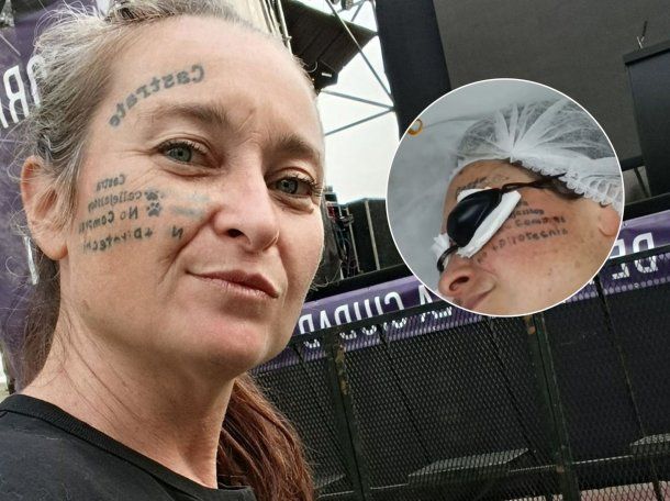 La libertaria Geraldine Prais mostró cómo le quedó la cara tras borrarse los tatuajes: ¿se hizo uno nuevo?