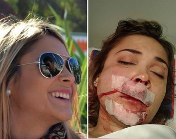 Ésta es la joven brutalmente agredida por patovicas