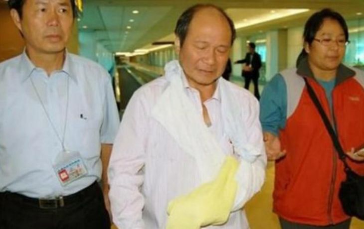 Se cortó la mano para engañar al seguro