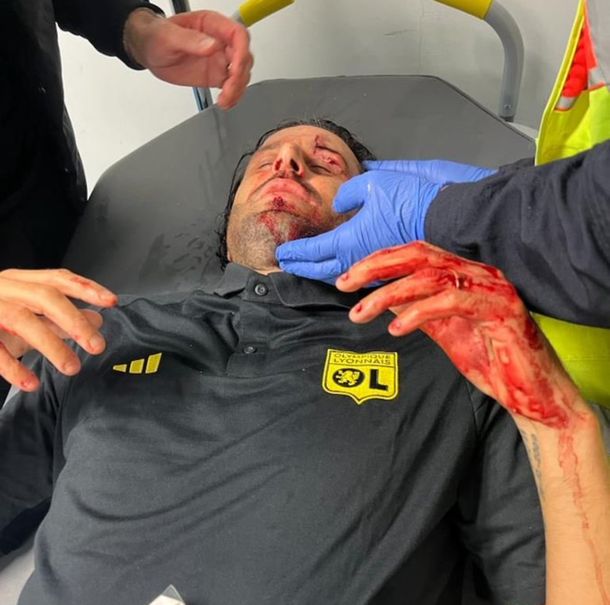 El micro del Olympique de Lyon fue atacado a piedrazos en la previa al clásico con Marsella