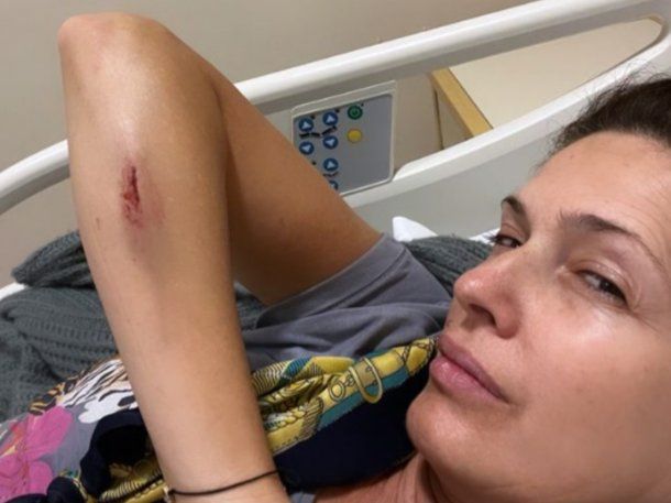 Isabel Macedo sufrió un accidente doméstico y terminó en el hospital: Un susto inmenso