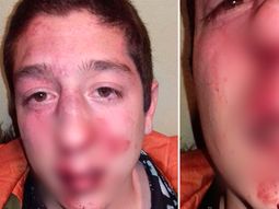 insolito: patovicas le pegaron por error y le dieron entradas gratis como disculpas insolito: patovicas le pegaron por error y le dieron entradas gratis como disculpas