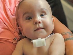 un bebe sobrevive gracias a una impresora 3d un bebe sobrevive gracias a una impresora 3d