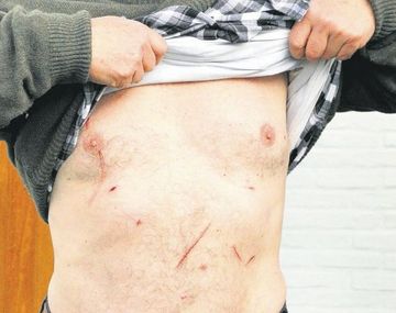 Se mudaron a Punta del Este por seguridad y los asaltaron tres veces