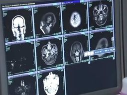 Comió carne en mal estado y más de 700 gusanos invadieron su cuerpo