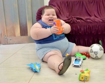 Dramático: niño de apenas 5 años que pesa 81 kilos