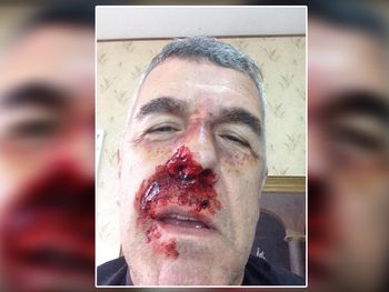 ¿Qué le pasó a Dady Brieva?