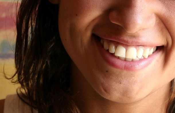 Sonrisa