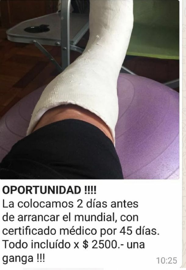 La Mejor Excusa Para Ver El Mundial Desde Tu Casa Un Yeso Para Faltar Al Trabajo 