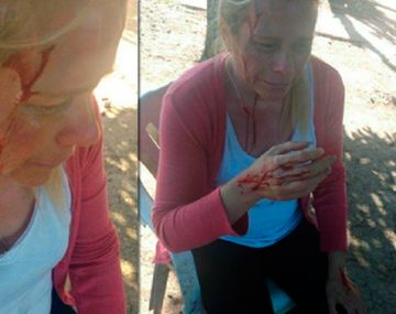 Así quedó la mujer tras la brutal agresión