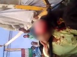 La adolescente perdió todo su pelo mientras se sacaba una selfie en un parque de atracciones. La adolescente perdió todo su pelo mientras se sacaba una selfie en un parque de atracciones.